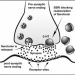 SSRIs To Treat Premature Ejaculation